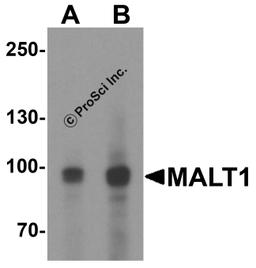Western blot analysis of MALT1 in EL4 cell lysate with MALT1 antibody at (A) 1 and (2) μg/ml.