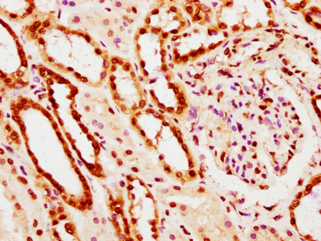 IHC image of CSB-PA010403PA20nacHU diluted at 1:10 and staining in paraffin-embedded human kidney tissue performed on a Leica BondTM system. After dewaxing and hydration, antigen retrieval was mediated by high pressure in a citrate buffer (pH 6.0). Section was blocked with 10% normal goat serum 30min at RT. Then primary antibody (1% BSA) was incubated at 4°C overnight. The primary is detected by a biotinylated secondary antibody and visualized using an HRP conjugated SP system.