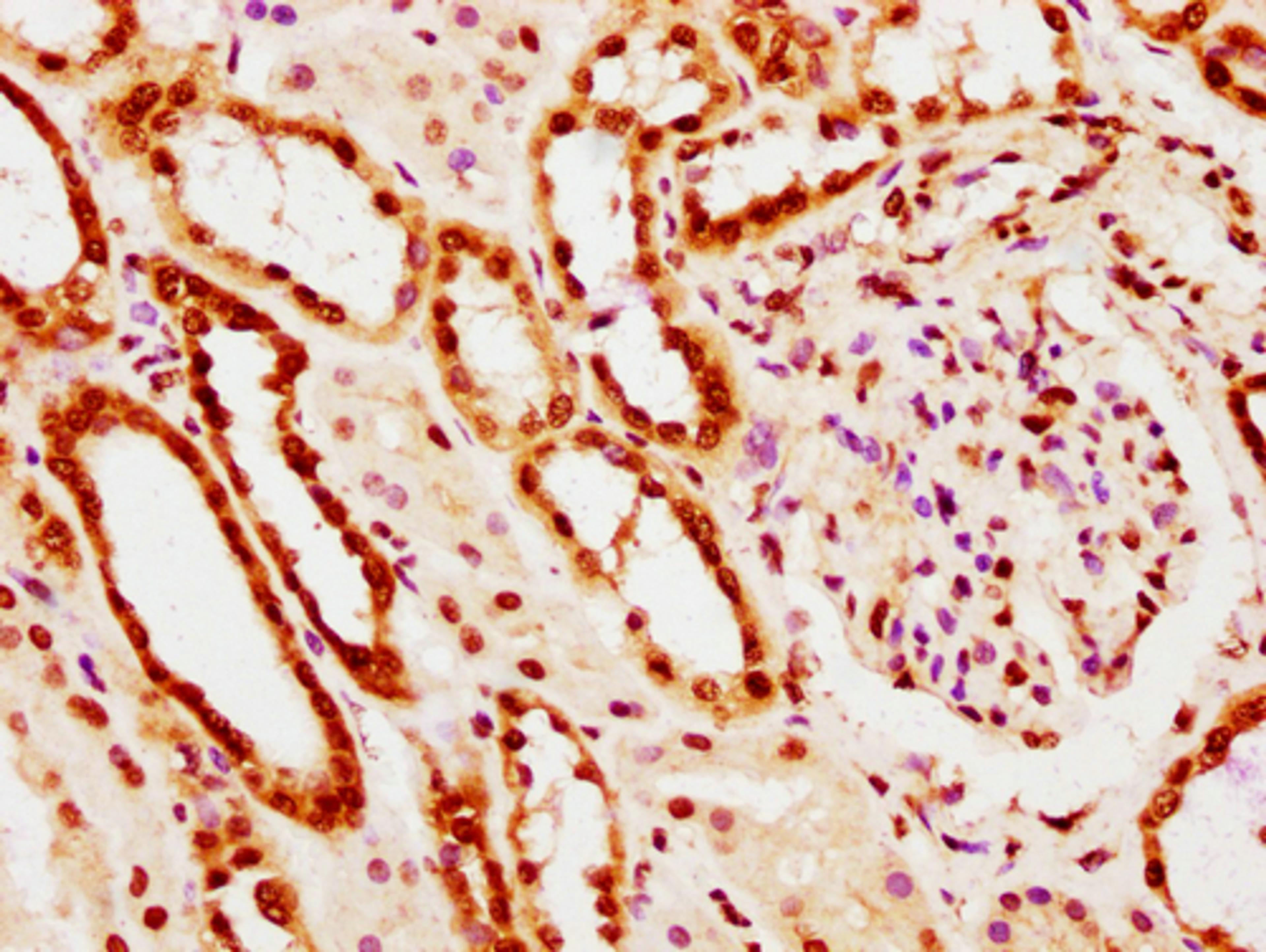 IHC image of CSB-PA010403PA20nacHU diluted at 1:10 and staining in paraffin-embedded human kidney tissue performed on a Leica BondTM system. After dewaxing and hydration, antigen retrieval was mediated by high pressure in a citrate buffer (pH 6.0). Section was blocked with 10% normal goat serum 30min at RT. Then primary antibody (1% BSA) was incubated at 4°C overnight. The primary is detected by a biotinylated secondary antibody and visualized using an HRP conjugated SP system.