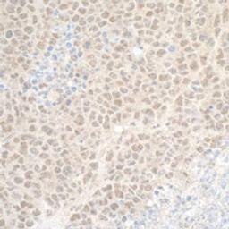 Detection of mouse DTL/CDT2 by immunohistochemistry. 