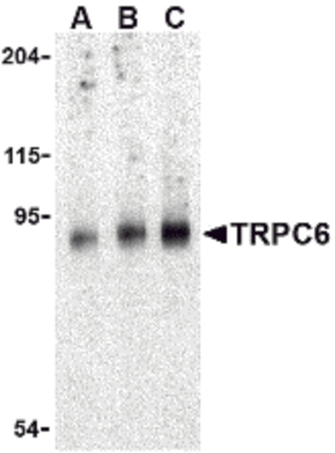 Western blot analysis of TRPC6 in mouse lung tissue lysate with TRPC6 antibody at (A) 0.5, (B) 1 and (C) 2 &#956;g/mL.