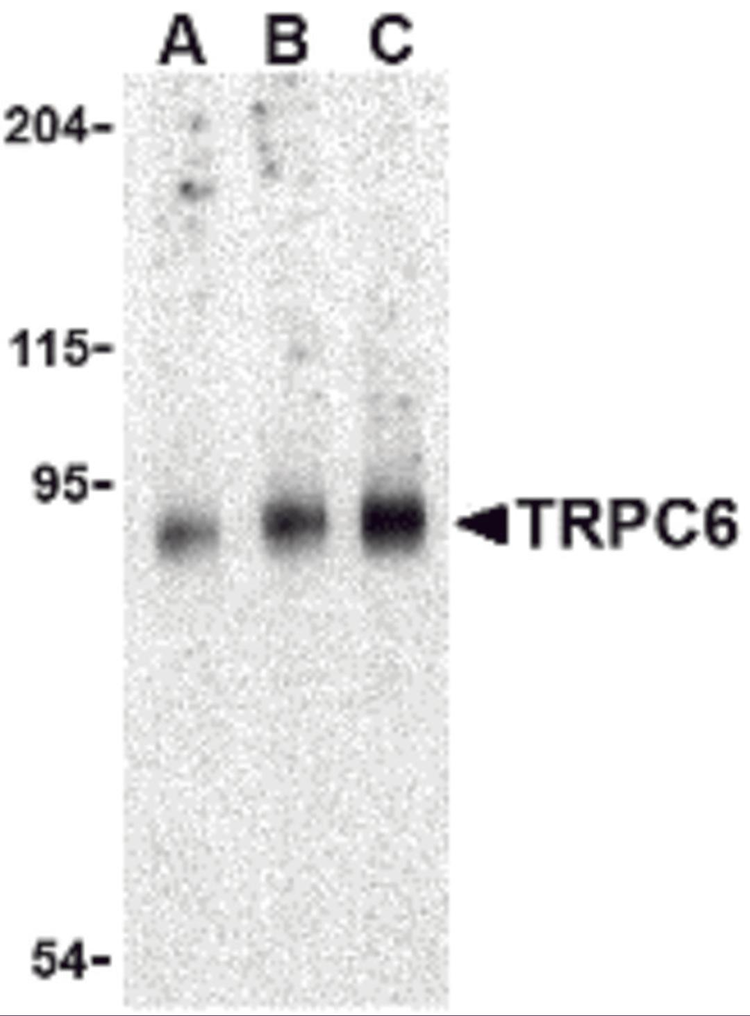 Western blot analysis of TRPC6 in mouse lung tissue lysate with TRPC6 antibody at (A) 0.5, (B) 1 and (C) 2 μg/mL.