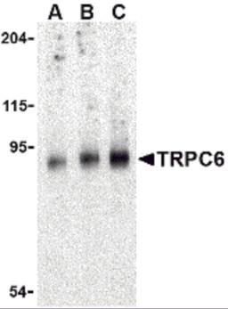 Western blot analysis of TRPC6 in mouse lung tissue lysate with TRPC6 antibody at (A) 0.5, (B) 1 and (C) 2 μg/mL.