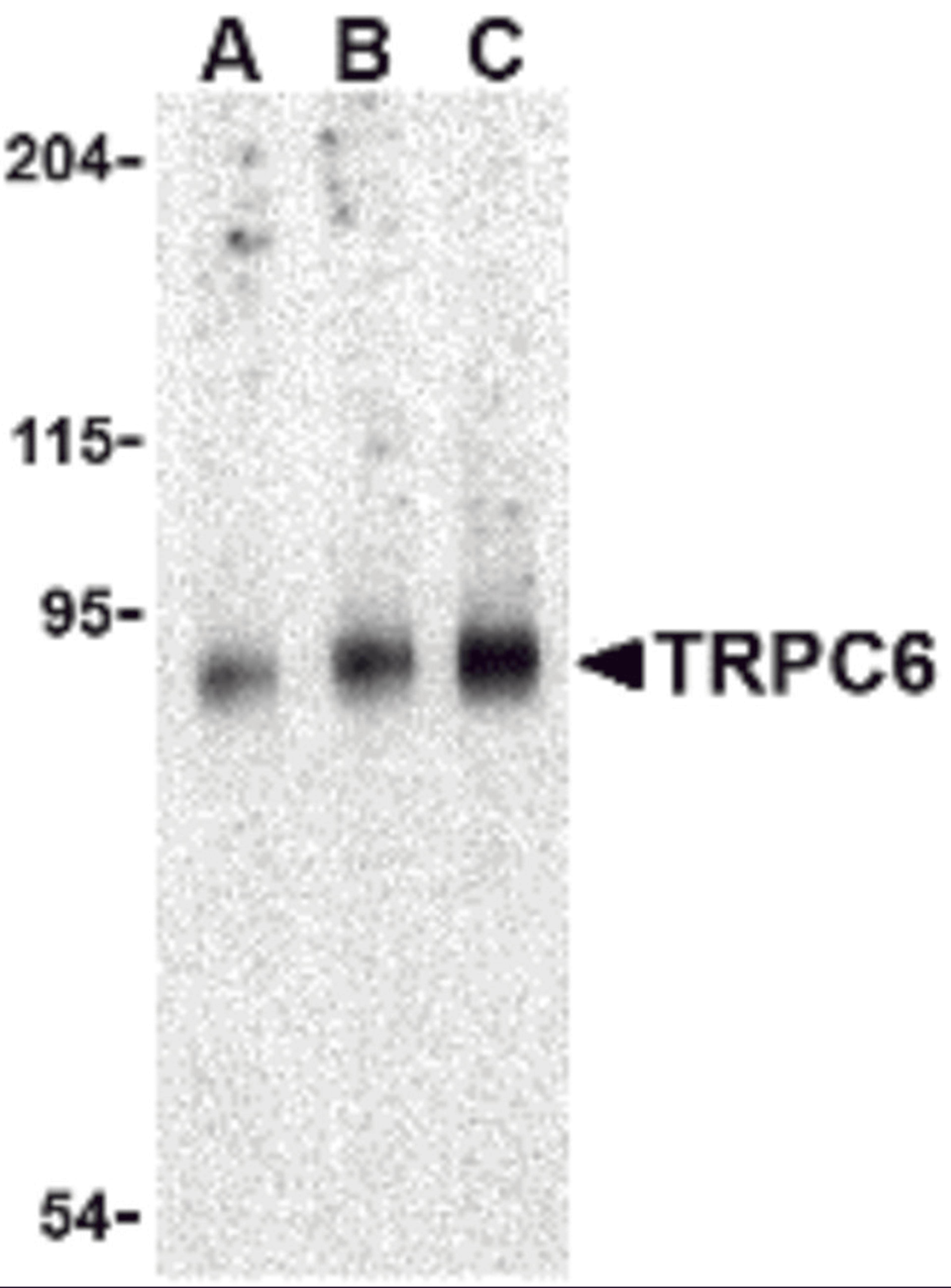 Western blot analysis of TRPC6 in mouse lung tissue lysate with TRPC6 antibody at (A) 0.5, (B) 1 and (C) 2 μg/mL.