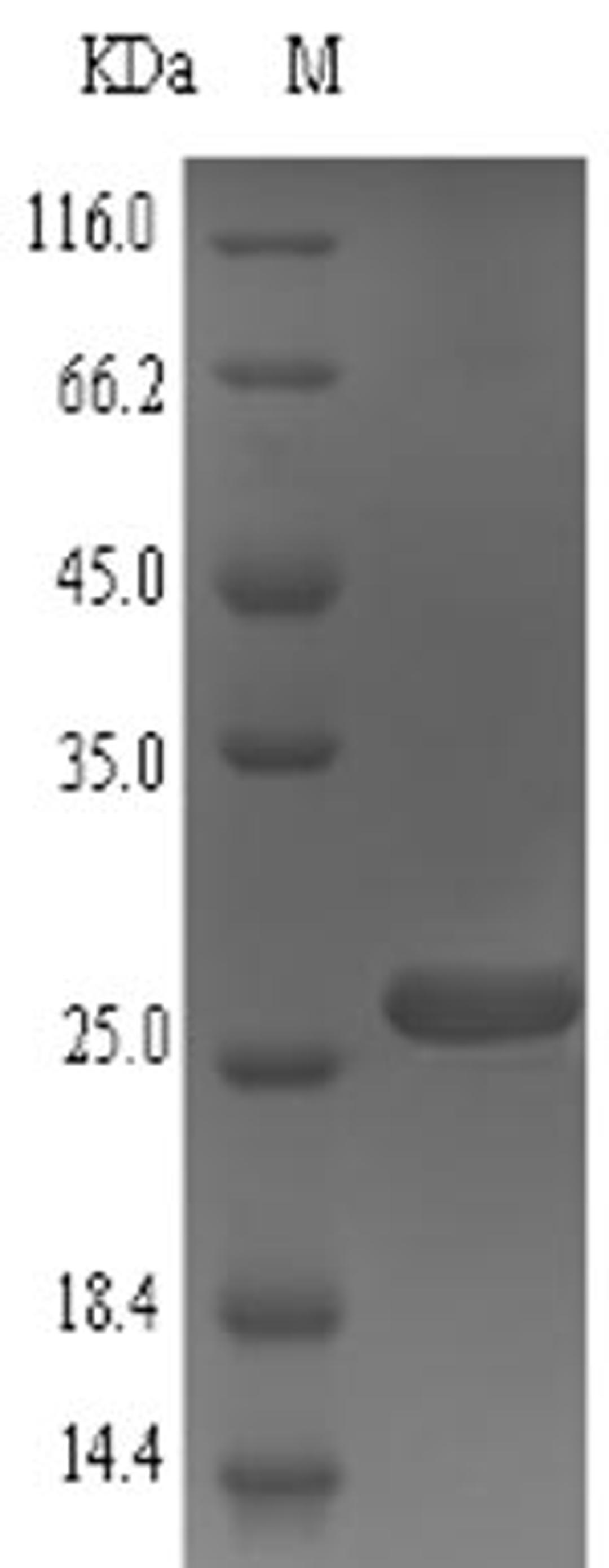 (Tris-Glycine gel) Discontinuous SDS-PAGE (reduced) with 5% enrichment gel and 15% separation gel.