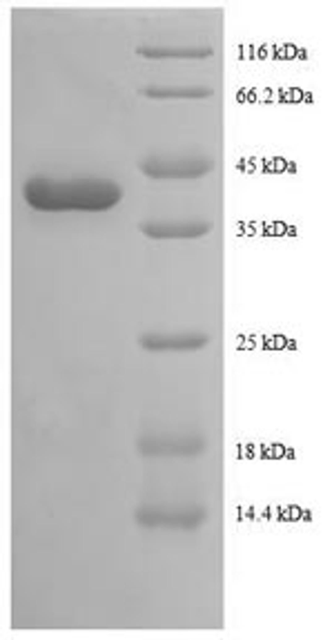 (Tris-Glycine gel) Discontinuous SDS-PAGE (reduced) with 5% enrichment gel and 15% separation gel.