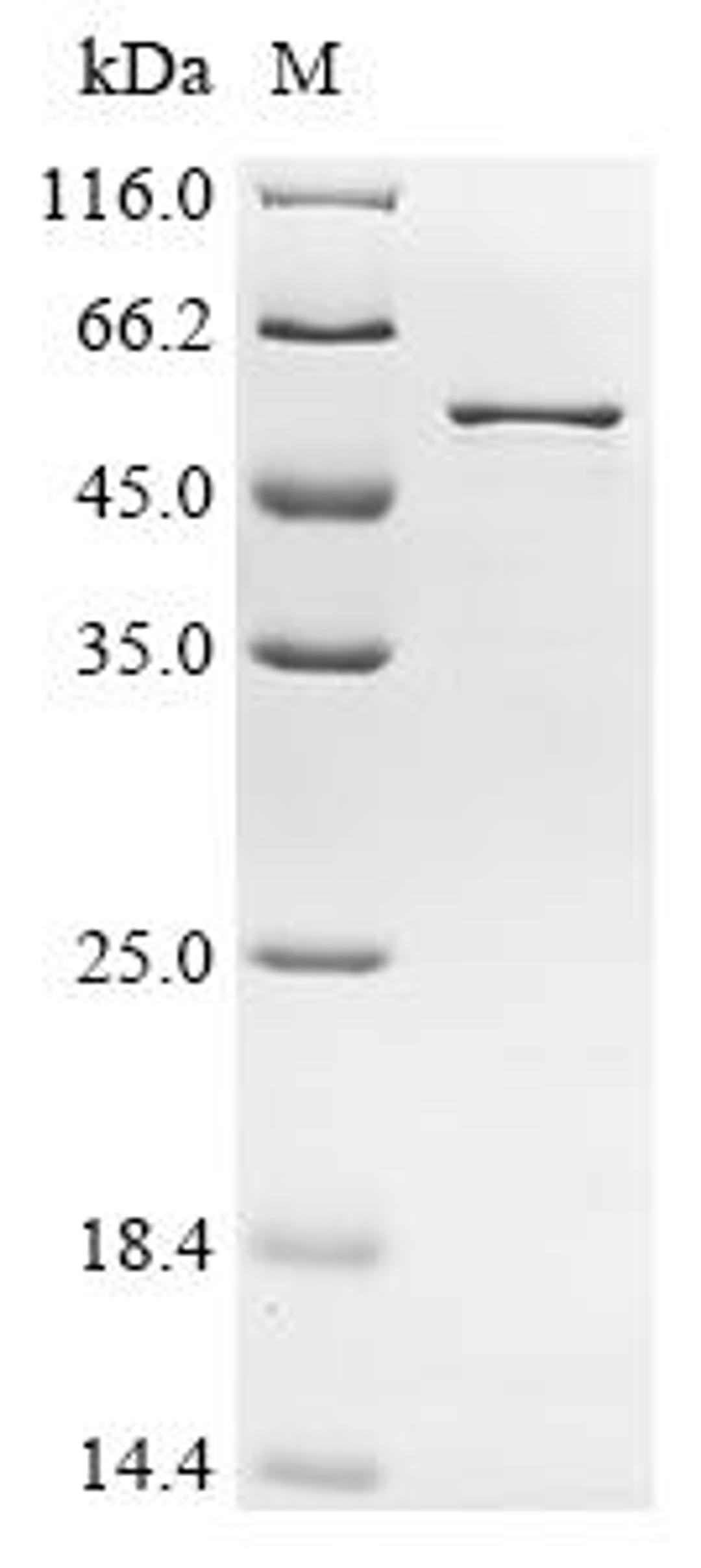 (Tris-Glycine gel) Discontinuous SDS-PAGE (reduced) with 5% enrichment gel and 15% separation gel.