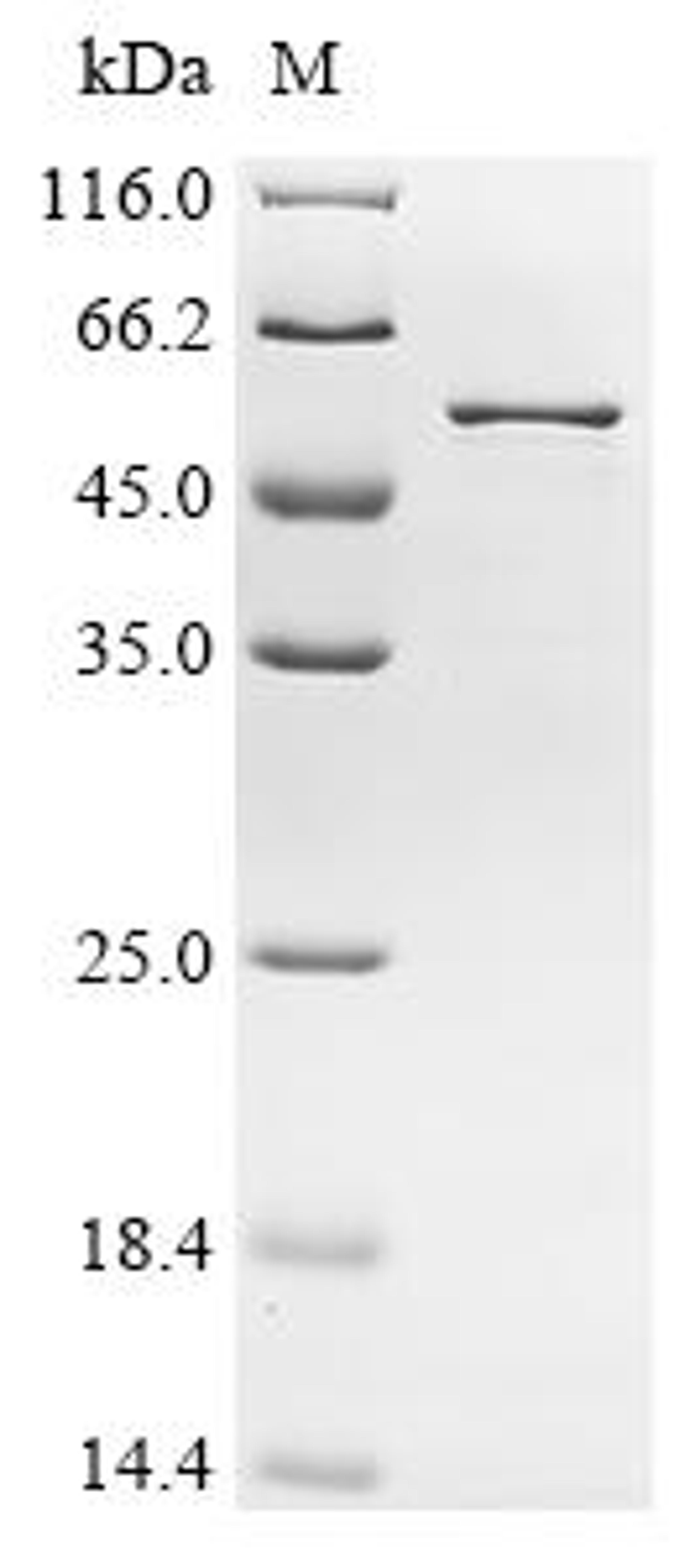 (Tris-Glycine gel) Discontinuous SDS-PAGE (reduced) with 5% enrichment gel and 15% separation gel.