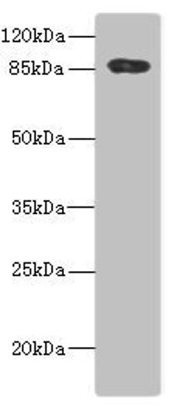 Western blot analysis of PC-3 whole cell lysate using ADAM28 antibody