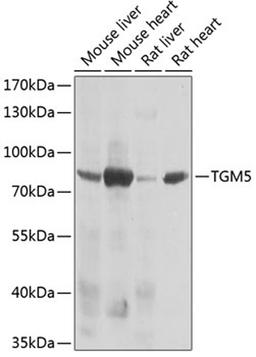 Western blot - TGM5 antibody (A7039)