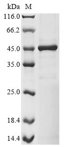 (Tris-Glycine gel) Discontinuous SDS-PAGE (reduced) with 5% enrichment gel and 15% separation gel.