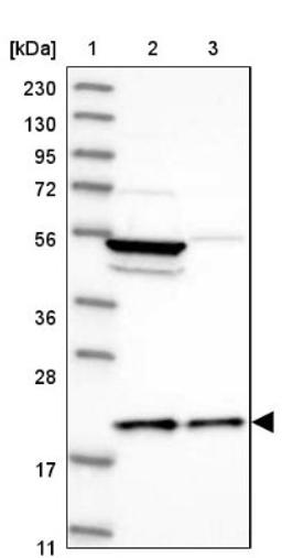 Western Blot: MRPL18 Antibody [NBP1-83176] - Lane 1: Marker [kDa] 230, 130, 95, 72, 56, 36, 28, 17, 11<br/>Lane 2: Human cell line RT-4<br/>Lane 3: Human cell line U-251MG sp