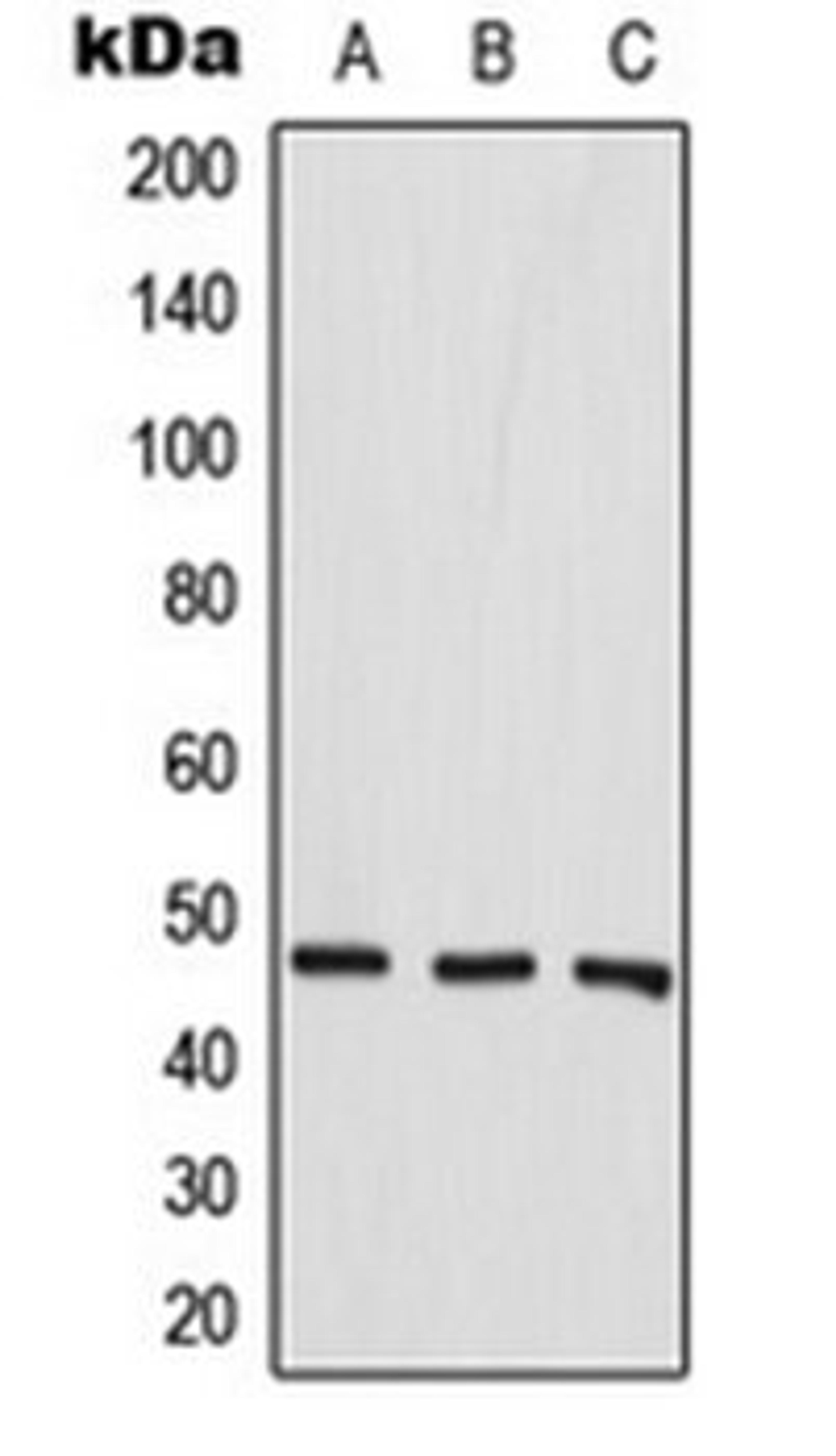 Western blot analysis of MCF7 (Lane 1), SP2/0 (Lane 2), H9C2 (Lane 3) whole cell lysates using Aurora A antibody