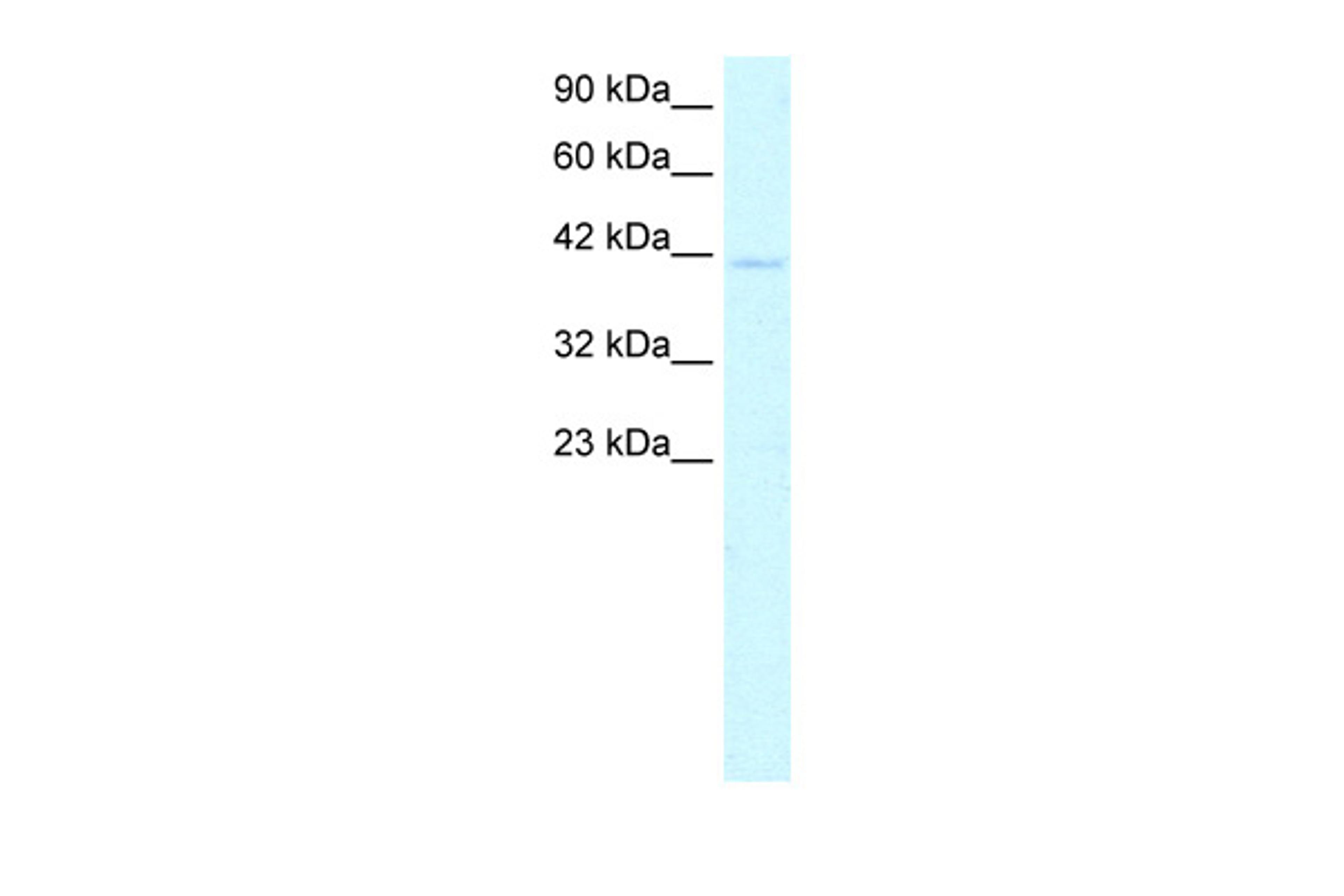 Antibody used in WB on Human HepG2 at 0.2-1 ug/ml.