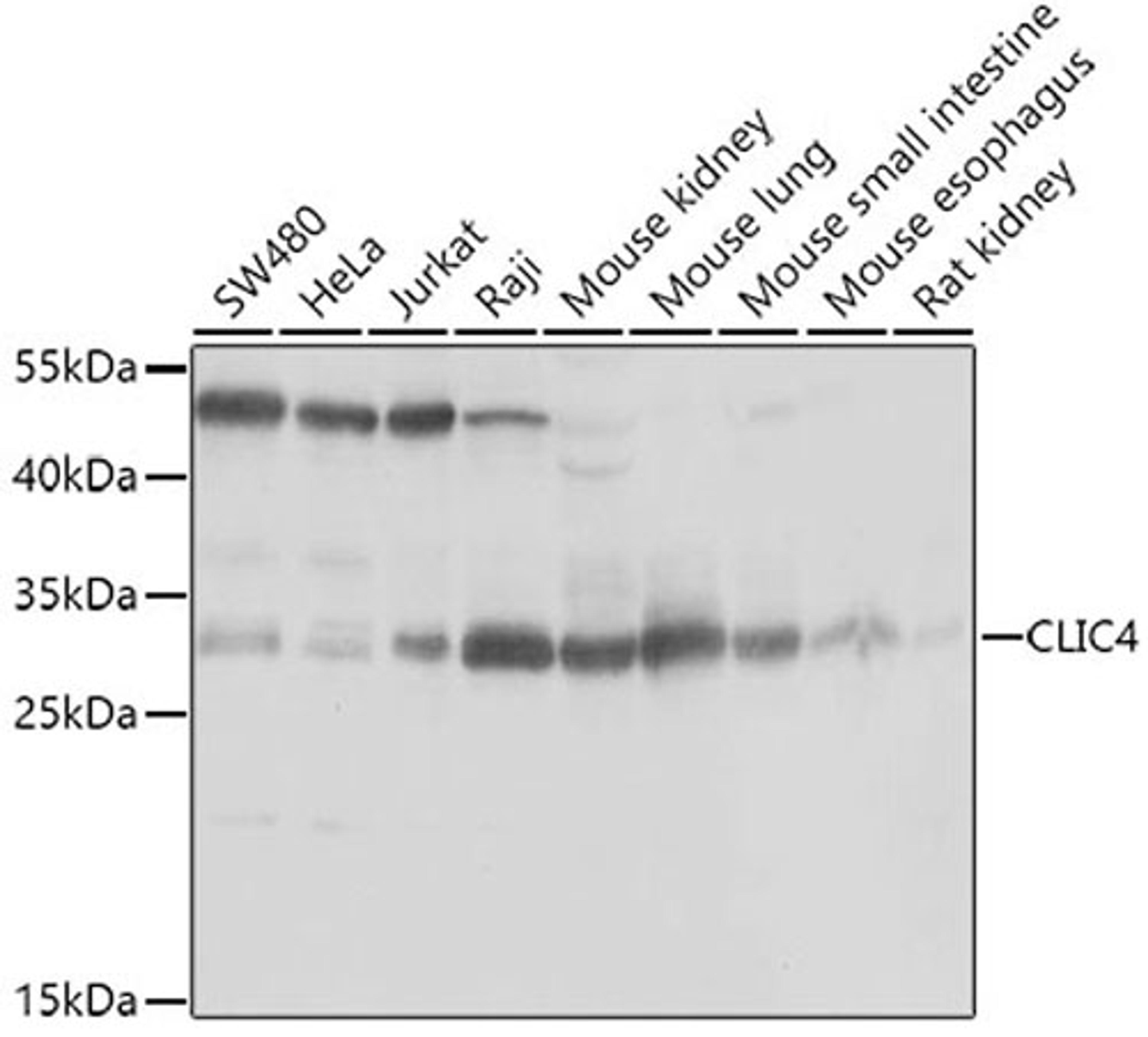 Western blot - CLIC4 antibody (A7088)