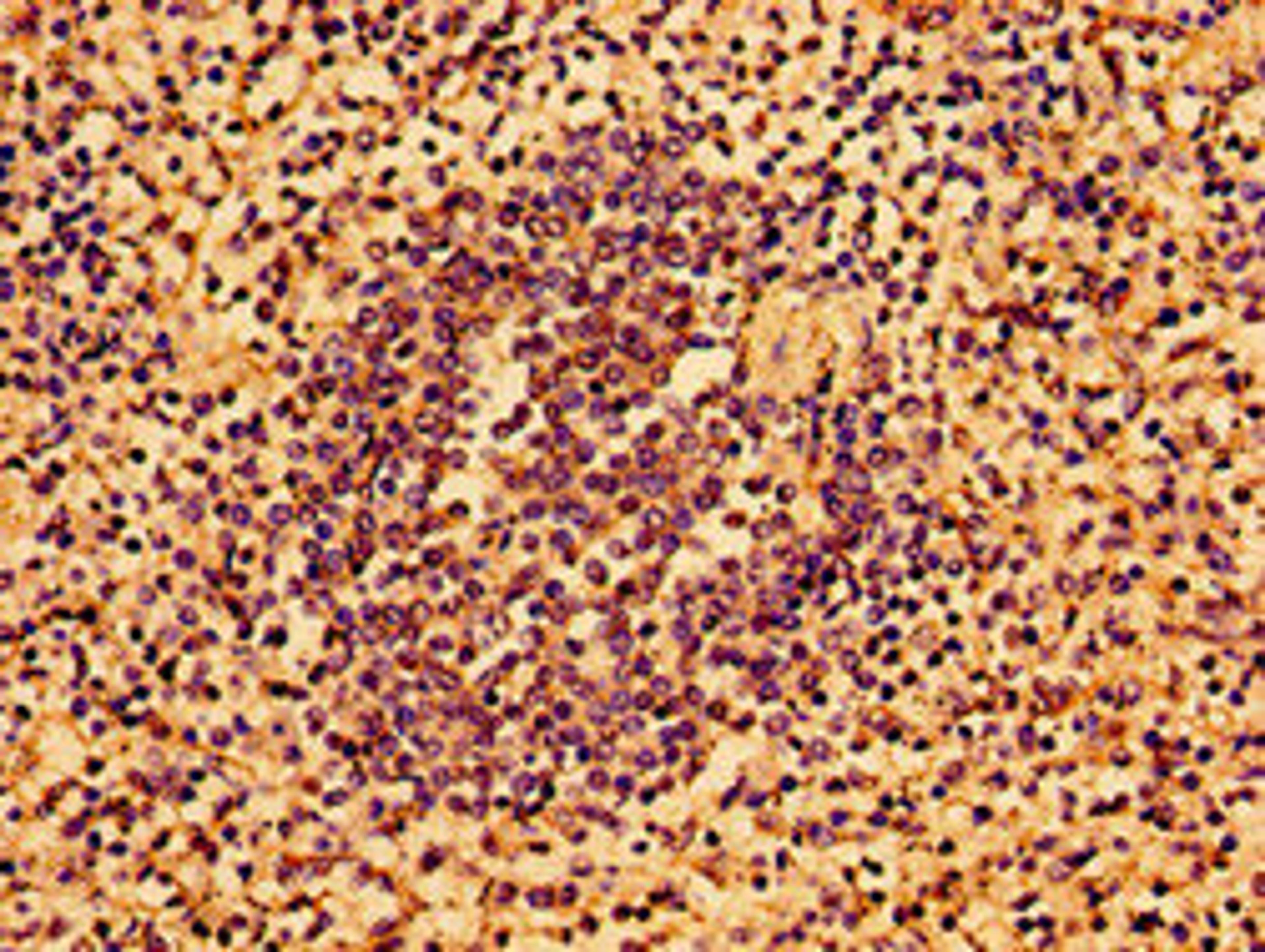 Immunohistochemistry of paraffin-embedded human spleen tissue using CSB-PA747468LA01HU at dilution of 1:100