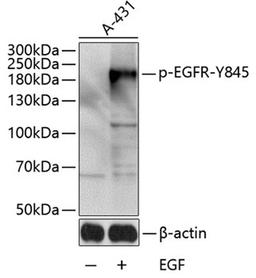 Western blot - Phospho-EGFR-Y845 antibody (AP0023)