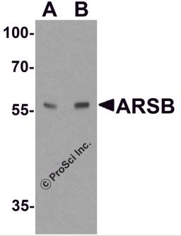 Western blot analysis of ARSB in mouse lung tissue lysate with ARSB antibody at (A) 1 and (B) 2 μg/ml.