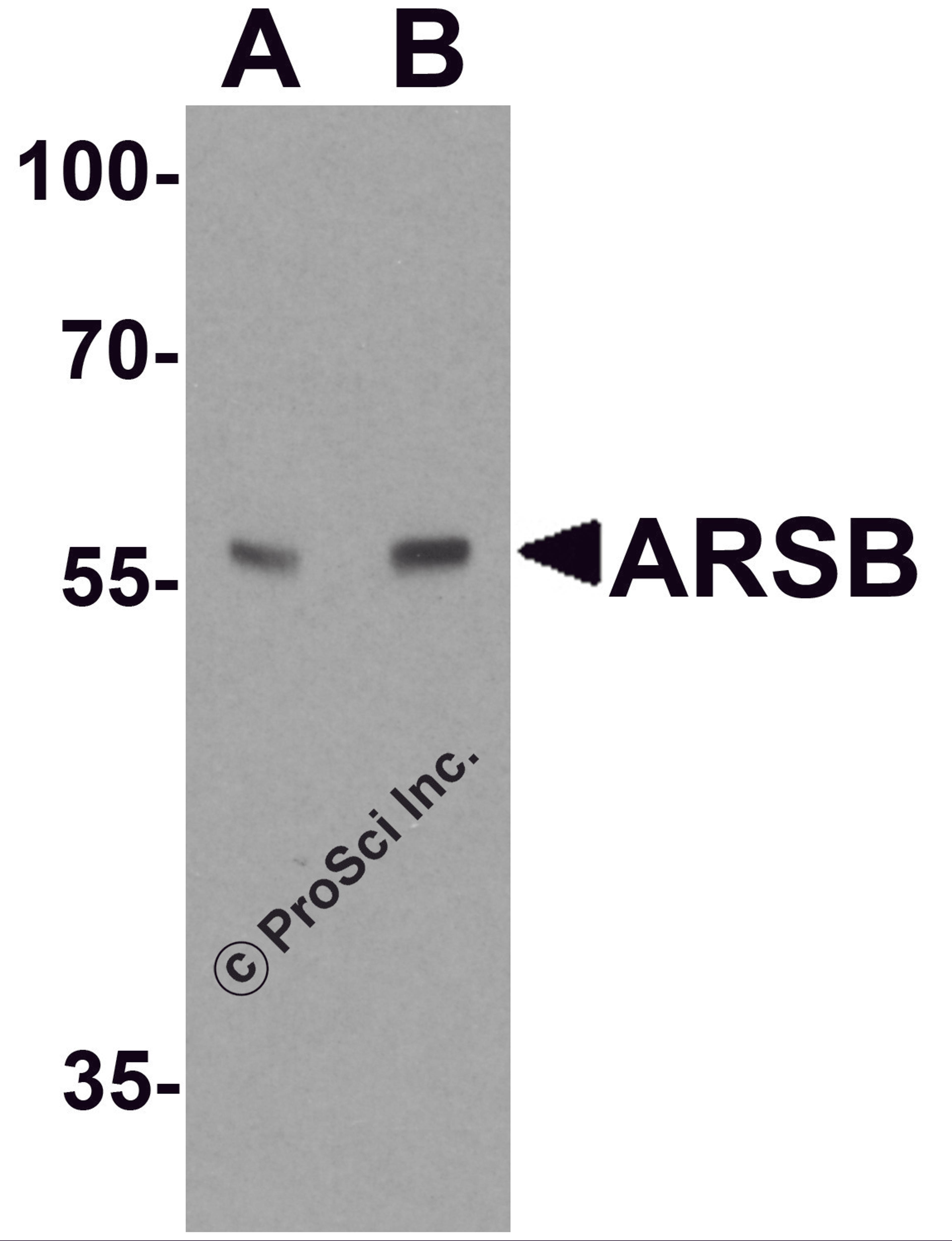 Western blot analysis of ARSB in mouse lung tissue lysate with ARSB antibody at (A) 1 and (B) 2 μg/ml.