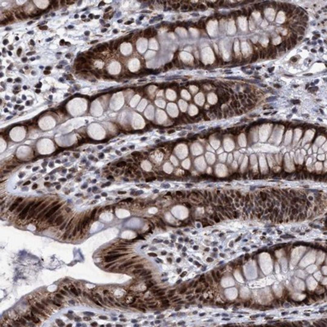 Immunohistochemistry-Paraffin: GLT6D1 Antibody [NBP1-81822] - Staining of human rectum shows strong nuclear and cytoplasmic positivity in glandular cells.