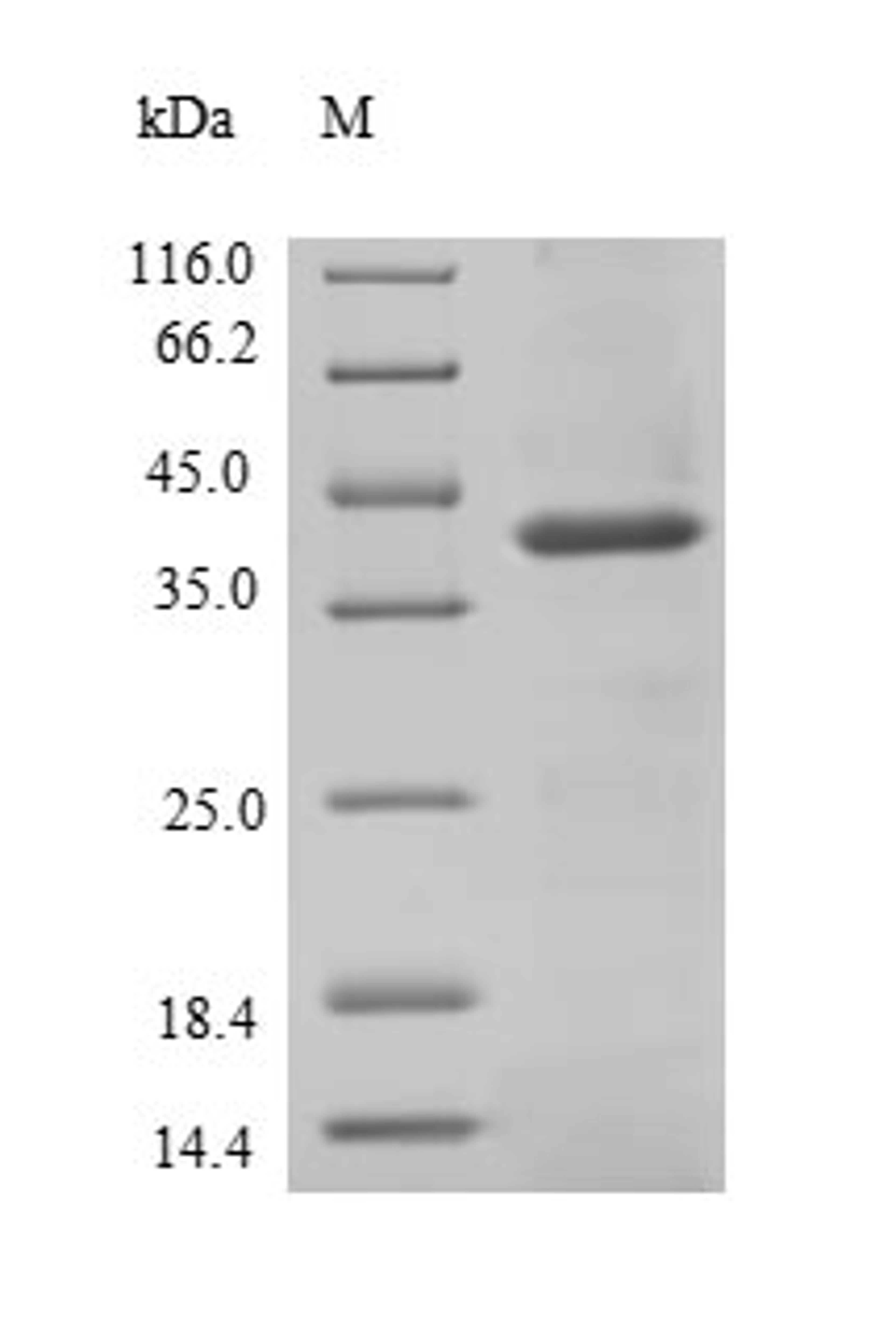 (Tris-Glycine gel) Discontinuous SDS-PAGE (reduced) with 5% enrichment gel and 15% separation gel.