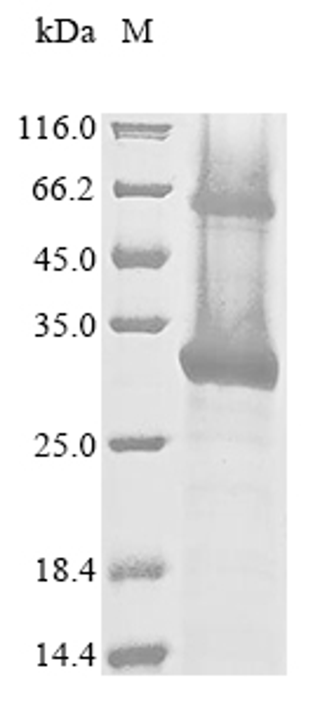(Tris-Glycine gel) Discontinuous SDS-PAGE (reduced) with 5% enrichment gel and 15% separation gel.