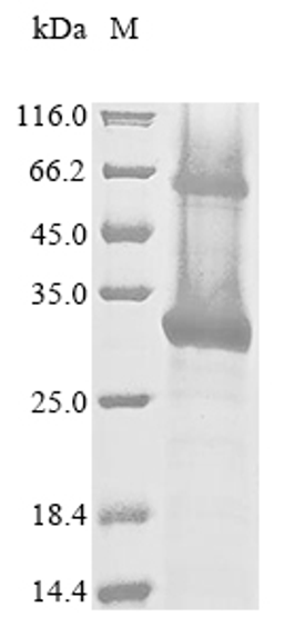 (Tris-Glycine gel) Discontinuous SDS-PAGE (reduced) with 5% enrichment gel and 15% separation gel.