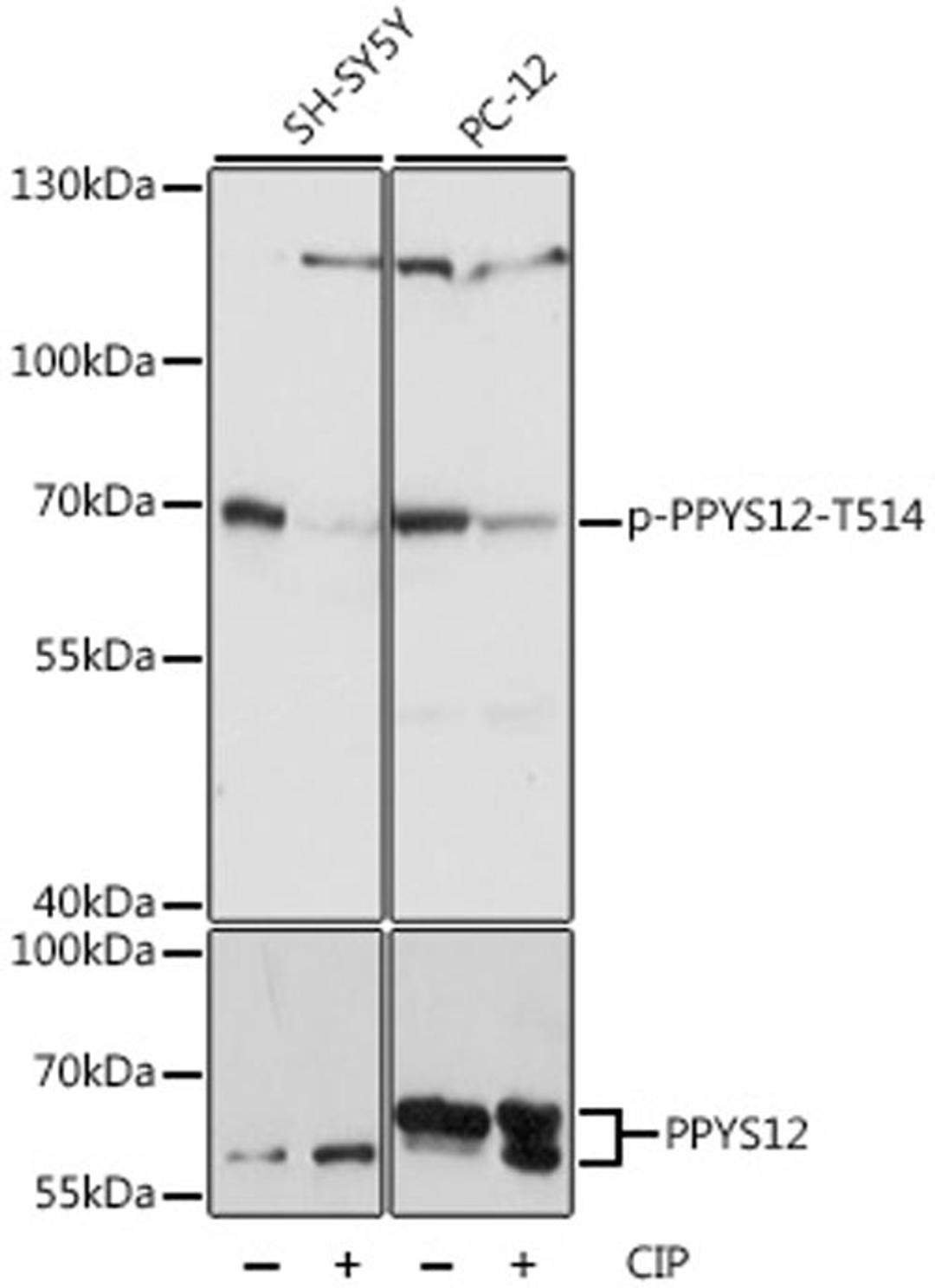 Western blot - Phospho-DPYSL2-T514 antibody (AP0821)