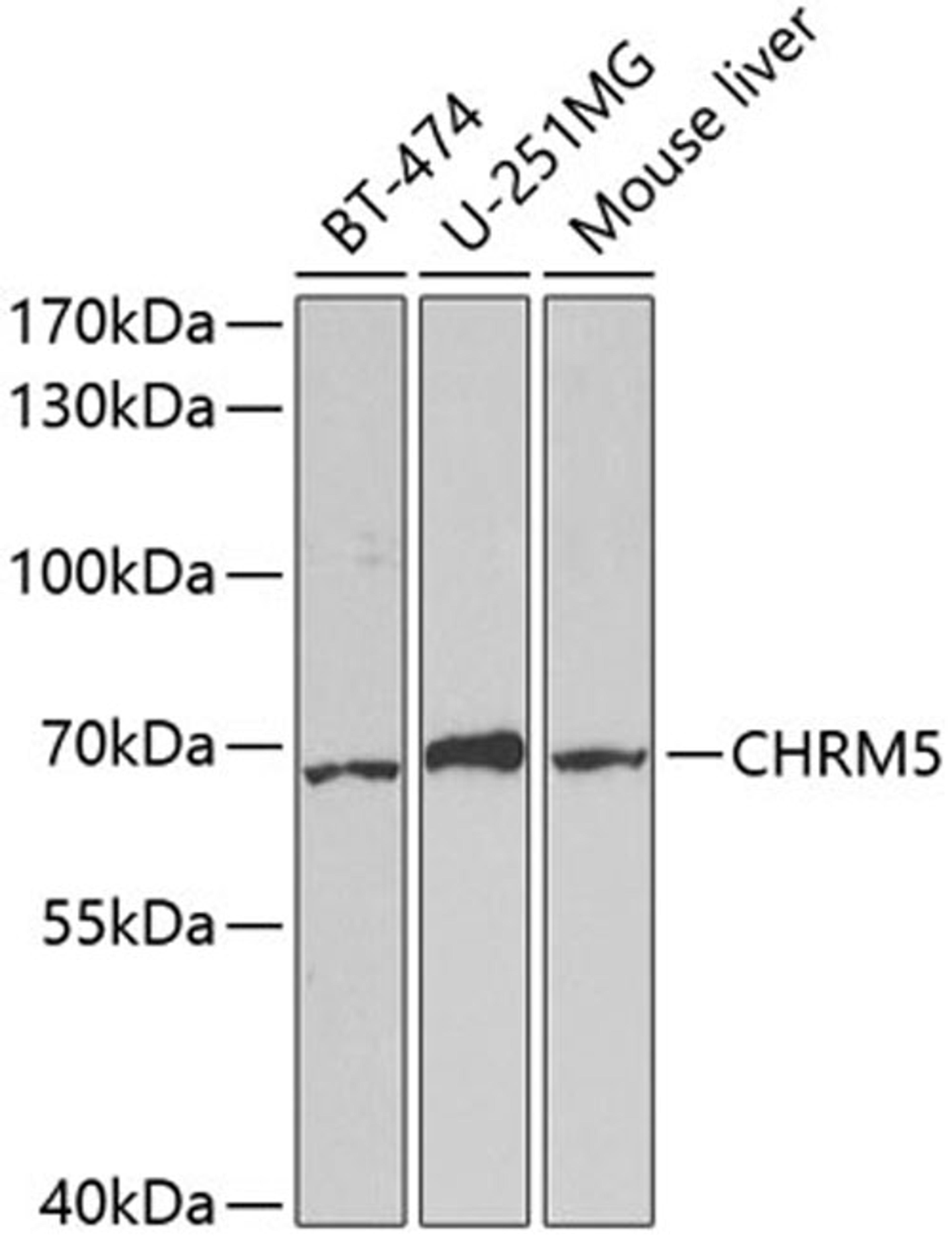 Western blot - CHRM5 antibody (A5367)