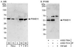 Detection of human and mouse PSMD11 by western blot (h&m) and immunoprecipitation (h).