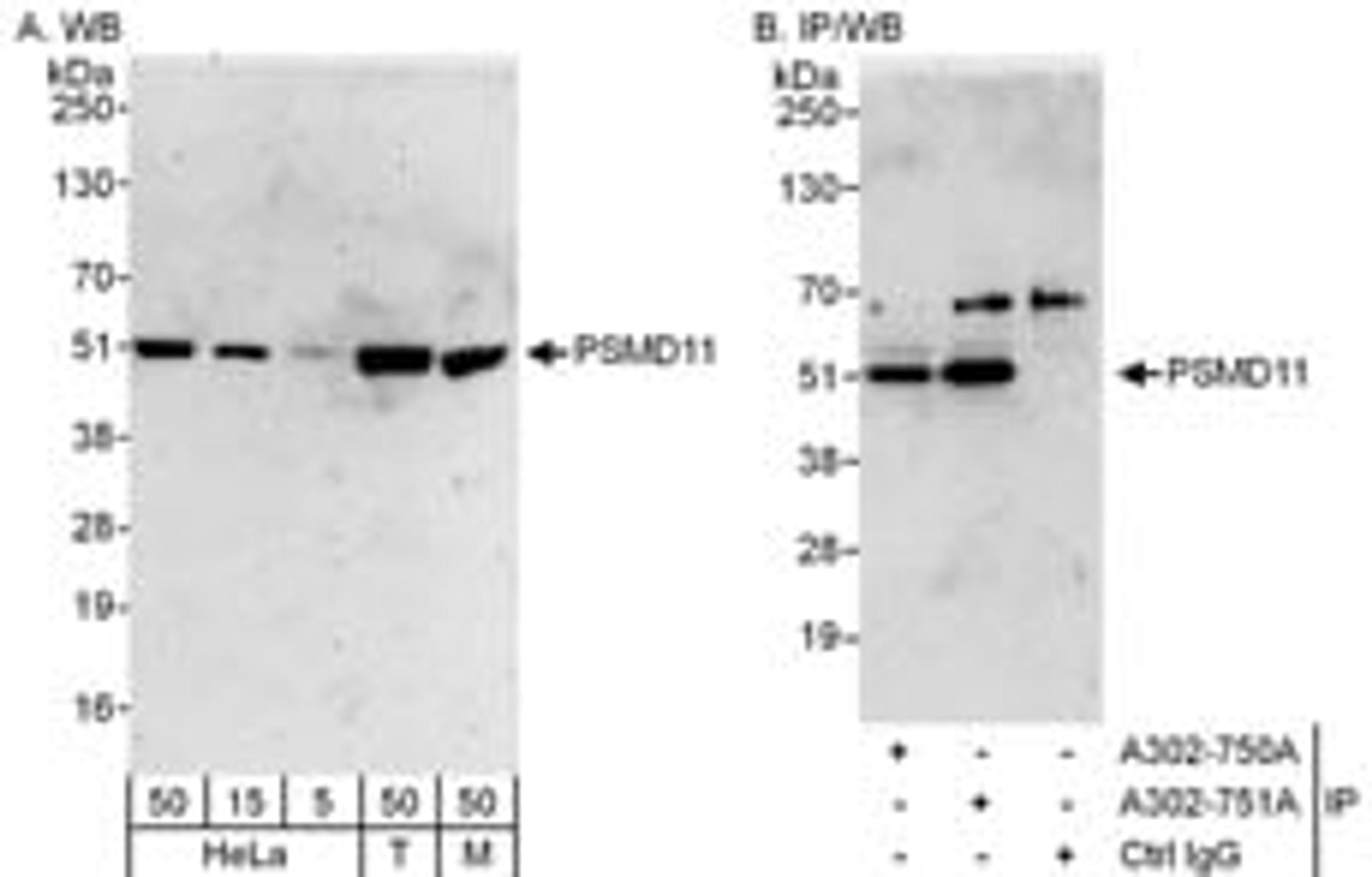 Detection of human and mouse PSMD11 by western blot (h&m) and immunoprecipitation (h).