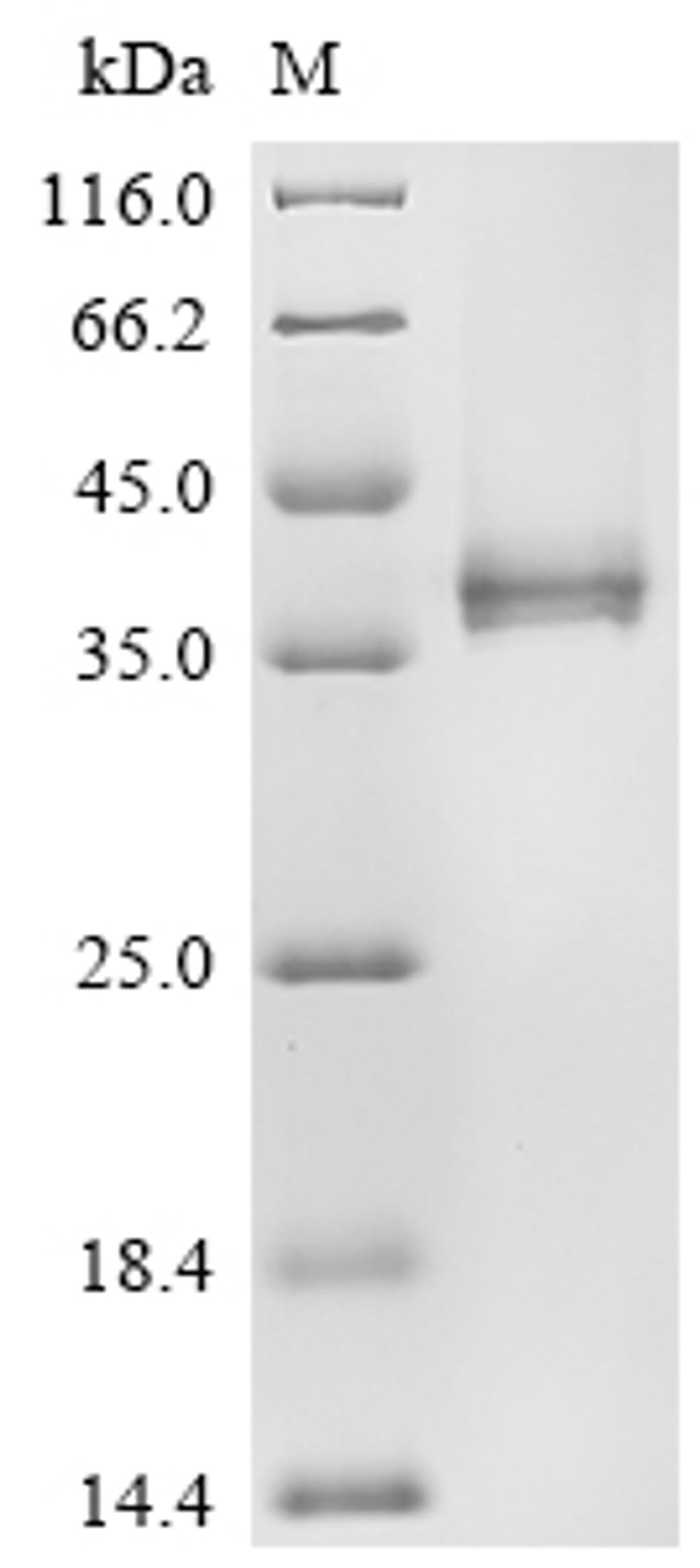 (Tris-Glycine gel) Discontinuous SDS-PAGE (reduced) with 5% enrichment gel and 15% separation gel.