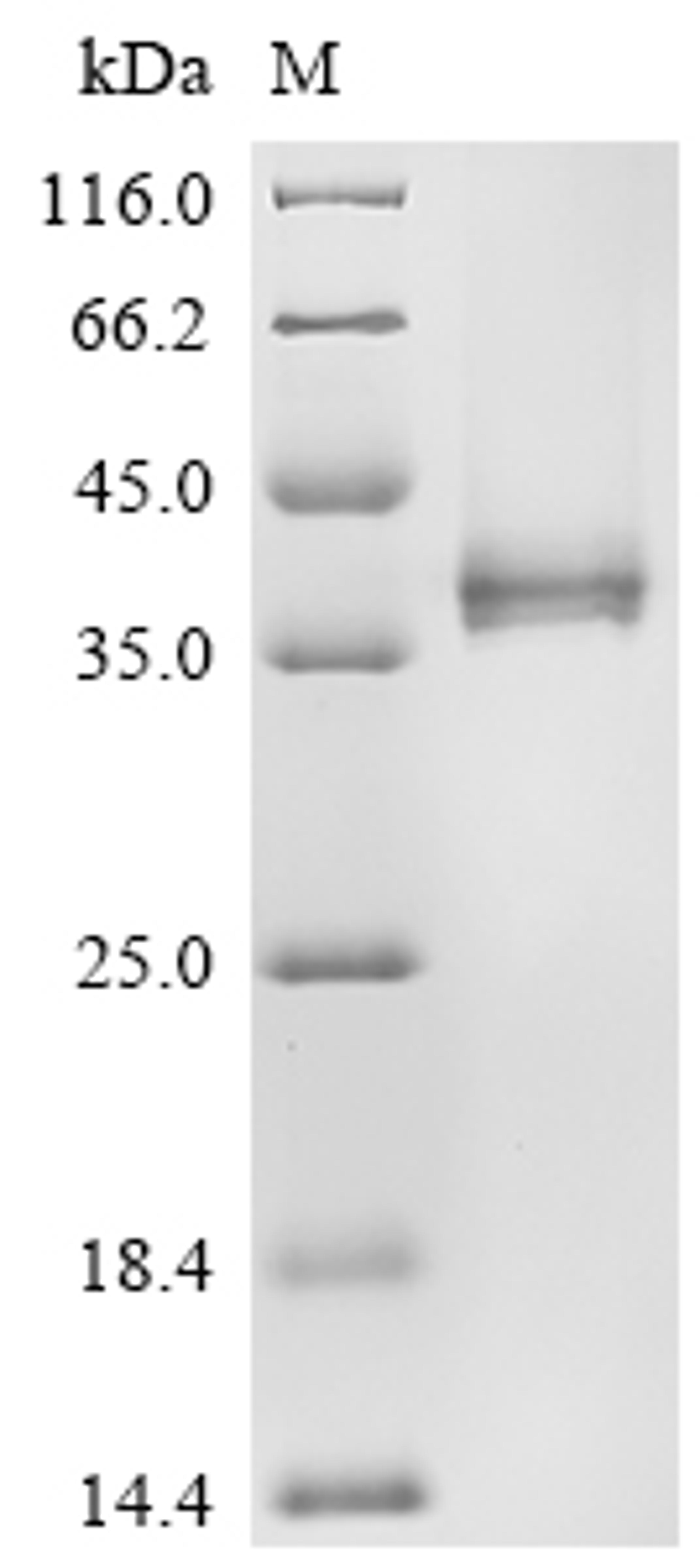 (Tris-Glycine gel) Discontinuous SDS-PAGE (reduced) with 5% enrichment gel and 15% separation gel.
