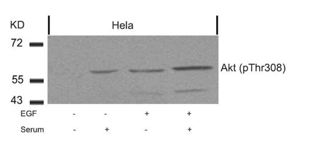 Western blot analysis of extracts from Hela cells untreated or treated with EGF, serum or both using Akt(Phospho-Thr308) Antibody.