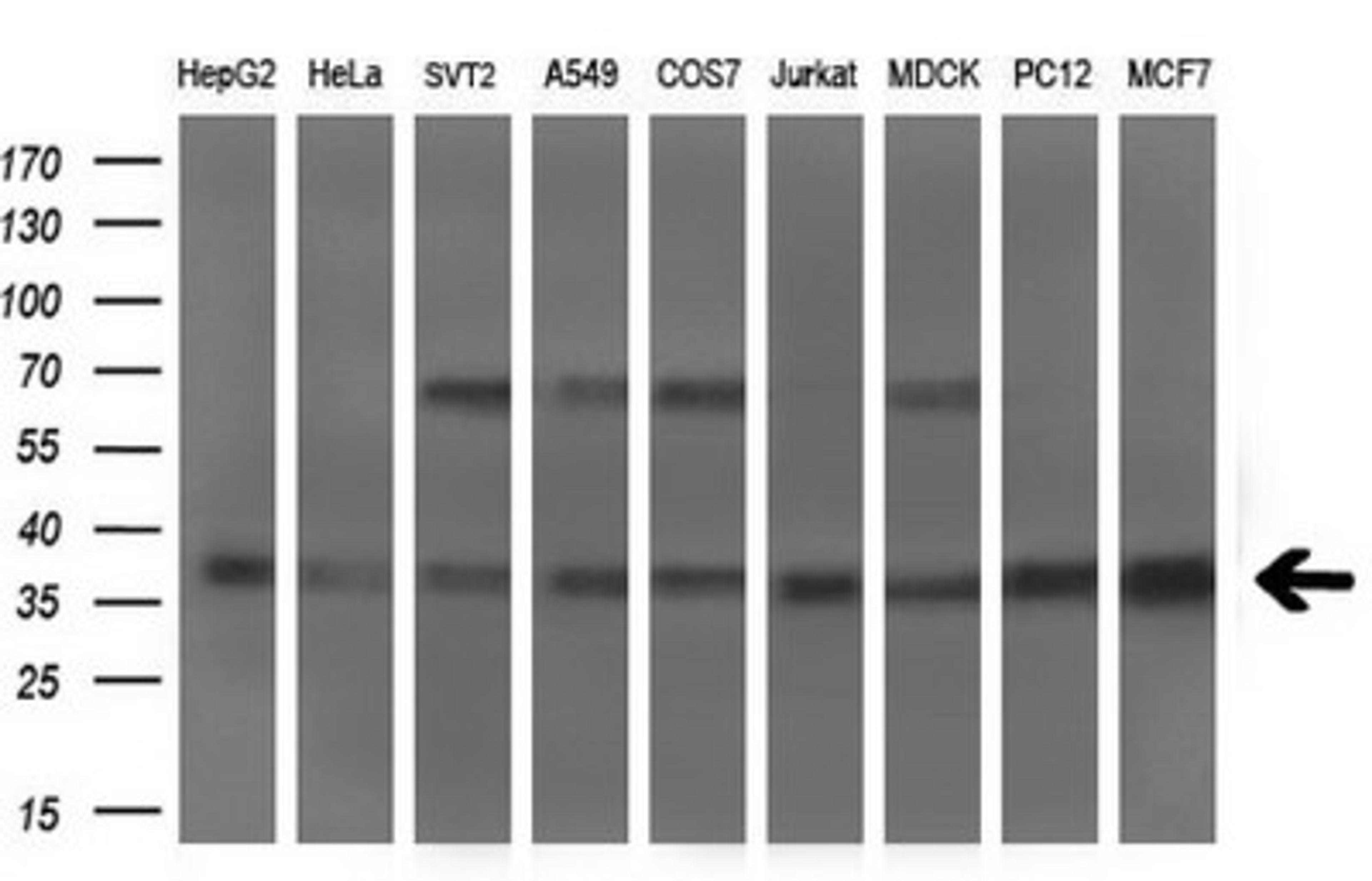 Western Blot: Musashi-2 Antibody (2F10) [NBP2-45837] - Analysis of extracts (35ug) from 9 different cell lines by using MSI2 monoclonal antibody (HepG2: human; HeLa: human; SVT2: mouse; A549: human; COS7: monkey; Jurkat: human; MDCK: canine; PC12: rat; MCF7: human).(1:200)