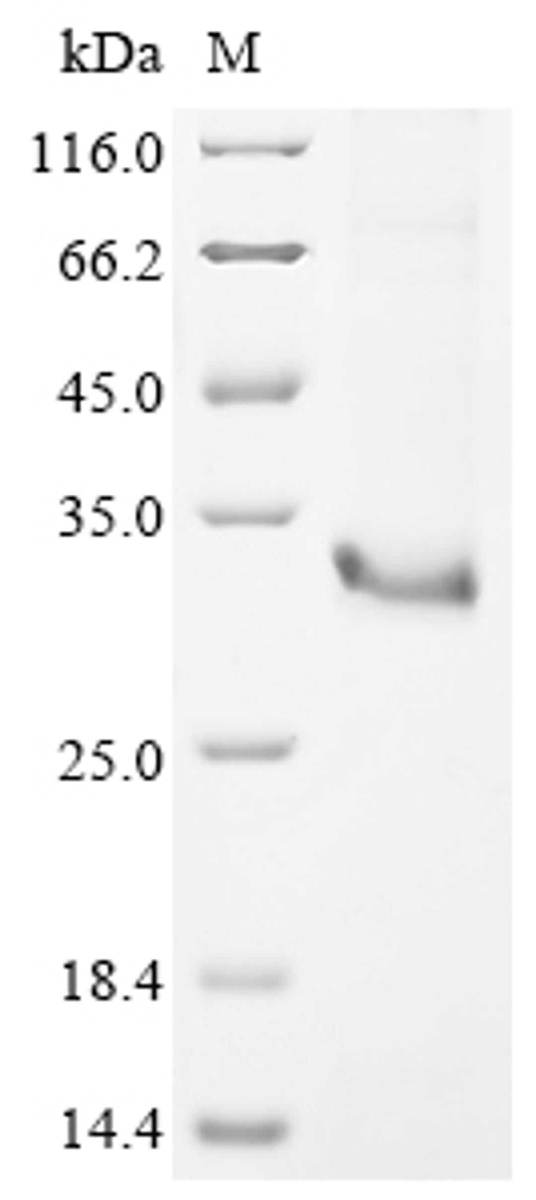 (Tris-Glycine gel) Discontinuous SDS-PAGE (reduced) with 5% enrichment gel and 15% separation gel.