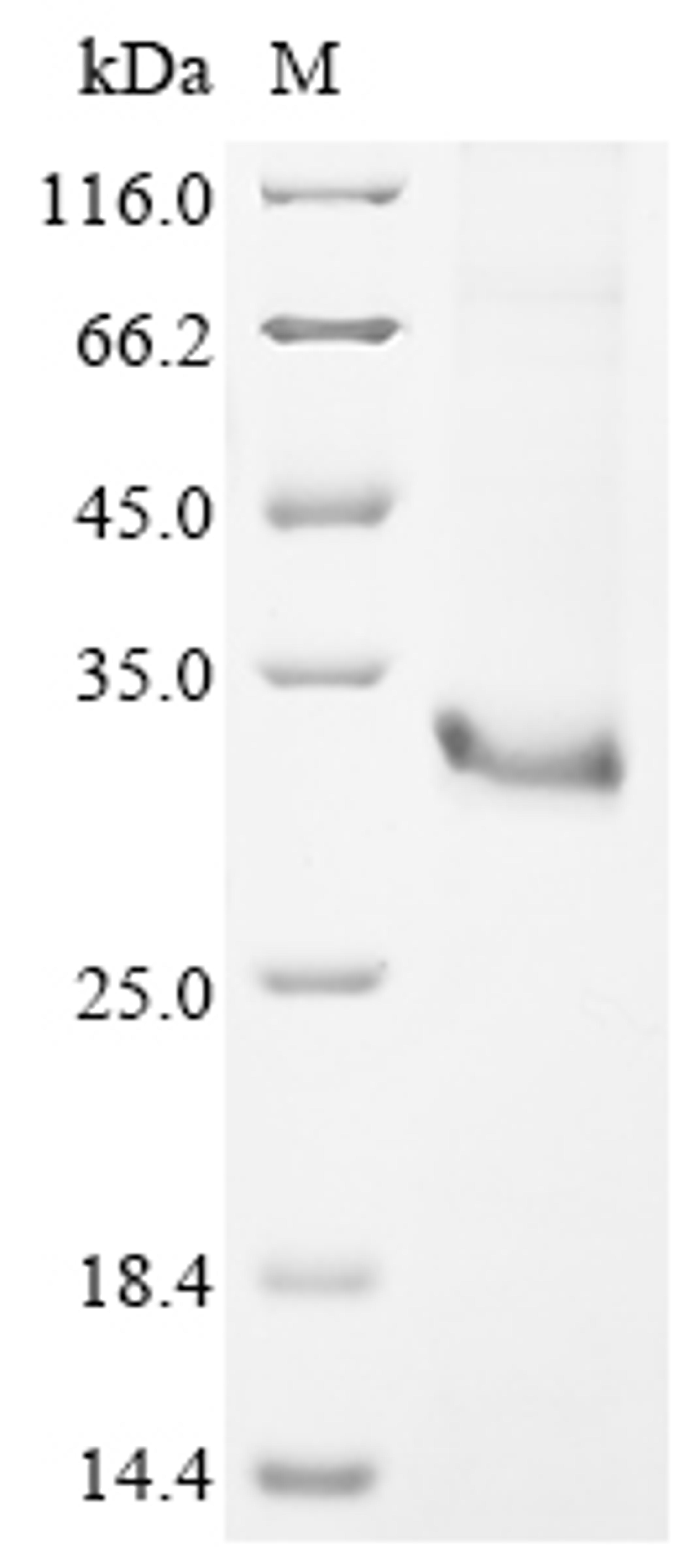(Tris-Glycine gel) Discontinuous SDS-PAGE (reduced) with 5% enrichment gel and 15% separation gel.