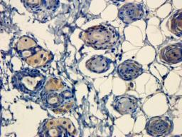 Immunohistochemical staining of paraffin embedded mouse skin tissue using anti-Integrin beta 1 (primary antibody at 1:100)