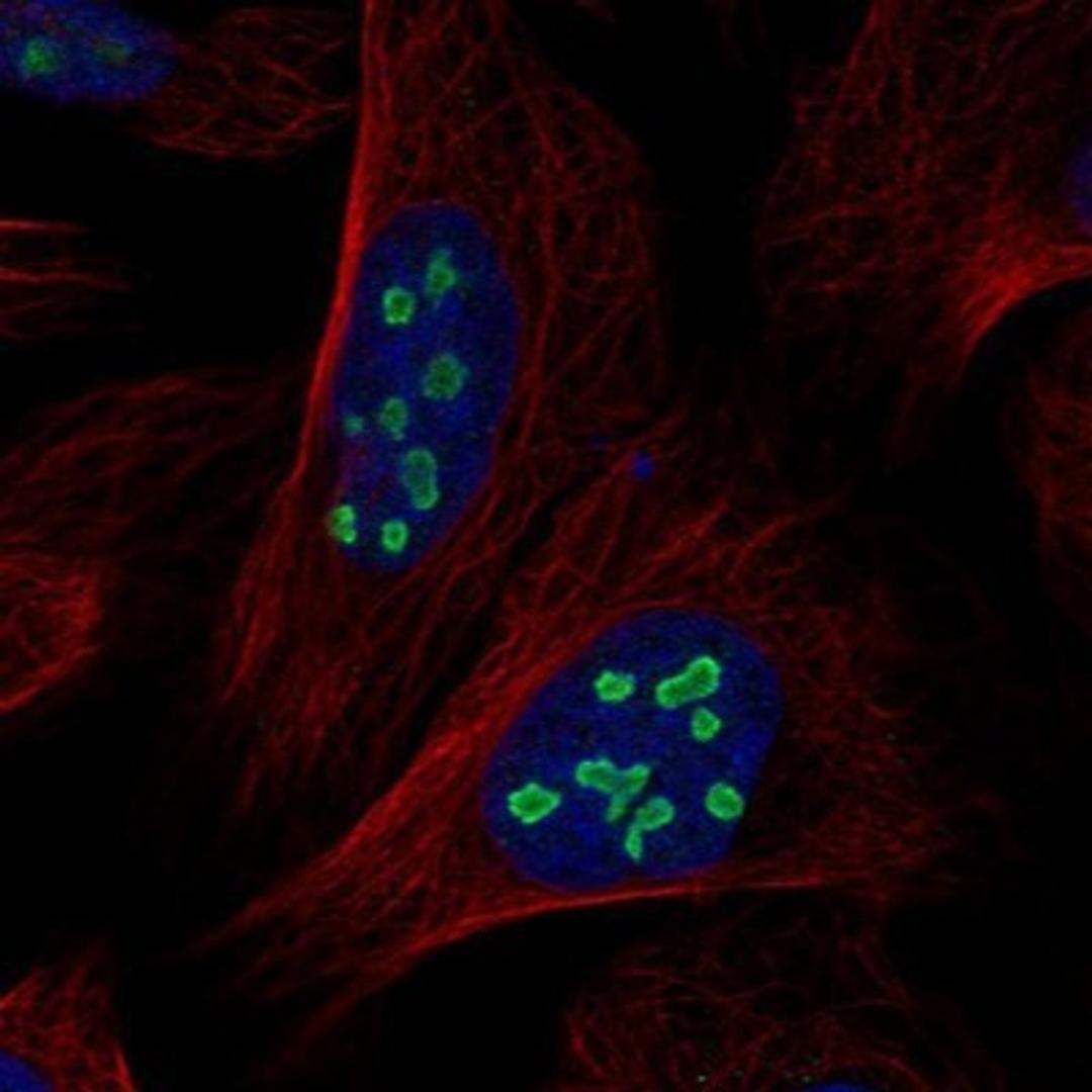 Immunocytochemistry/Immunofluorescence: ACTL6B Antibody [NBP1-91648] - Staining of human cell line U-2 OS shows positivity in nucleoli.