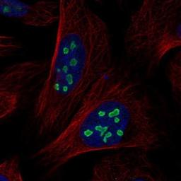 Immunocytochemistry/Immunofluorescence: ACTL6B Antibody [NBP1-91648] - Staining of human cell line U-2 OS shows positivity in nucleoli.