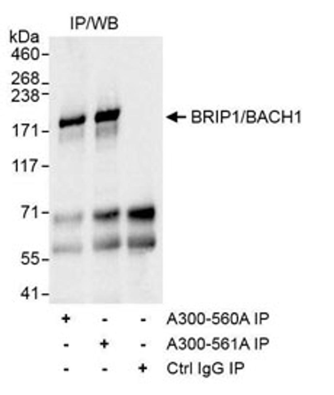 Detection of human BRIP1/BACH1 by western blot of immunoprecipitates.