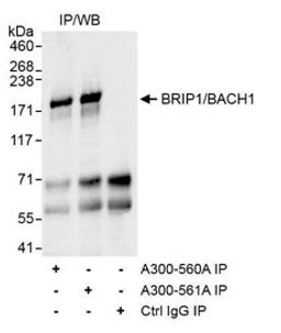 Detection of human BRIP1/BACH1 by western blot of immunoprecipitates.