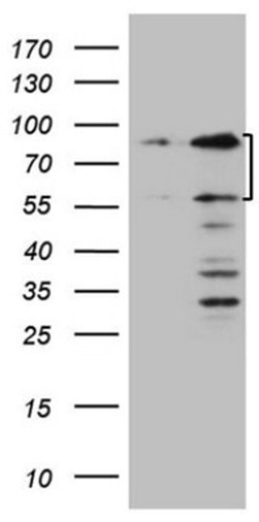 Western Blot: SP110 Antibody (4C1) [NBP2-45919] - Analysis of HEK293T cells were transfected with the pCMV6-ENTRY control (Left lane) or pCMV6-ENTRY SP110.