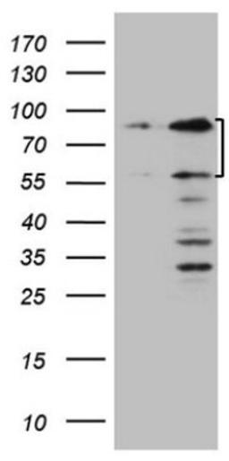 Western Blot: SP110 Antibody (4C1) [NBP2-45919] - Analysis of HEK293T cells were transfected with the pCMV6-ENTRY control (Left lane) or pCMV6-ENTRY SP110.