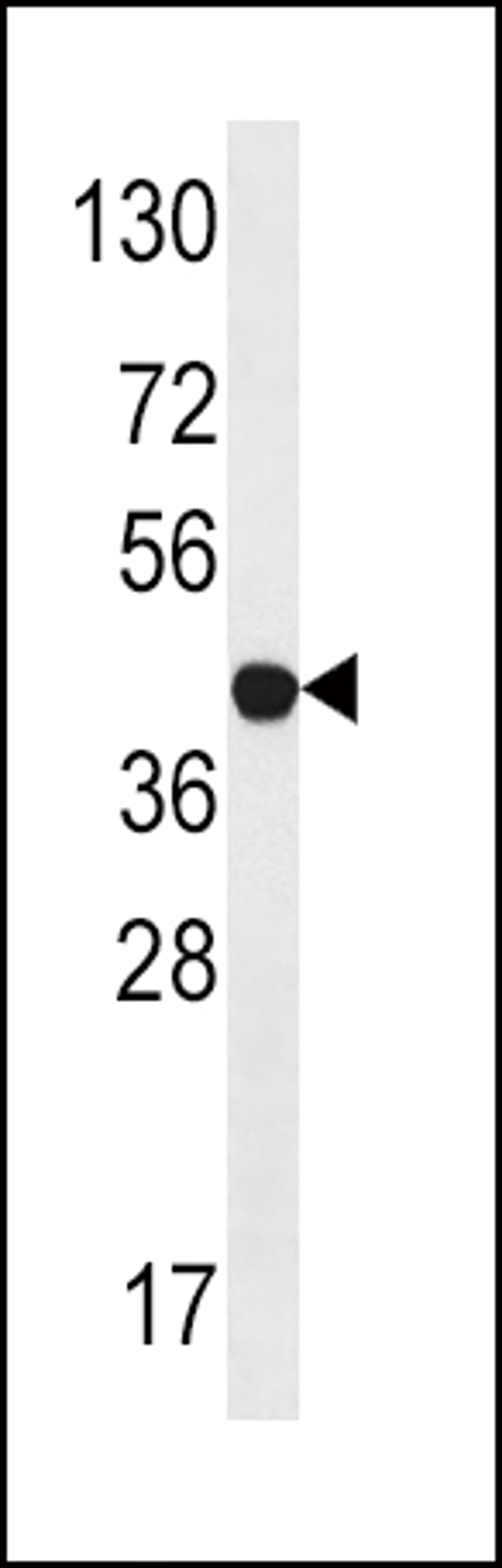 Antibody is used in Western blot to detect LYK5 in Jurkat tissue lysate