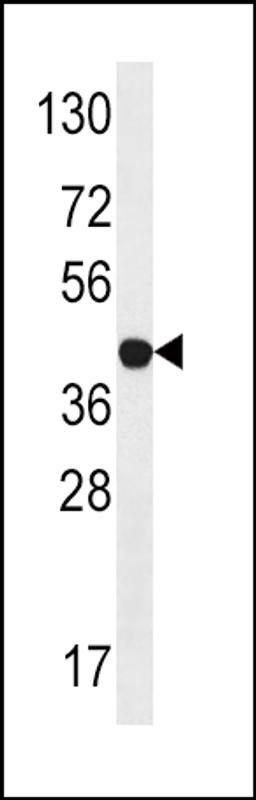 Antibody is used in Western blot to detect LYK5 in Jurkat tissue lysate