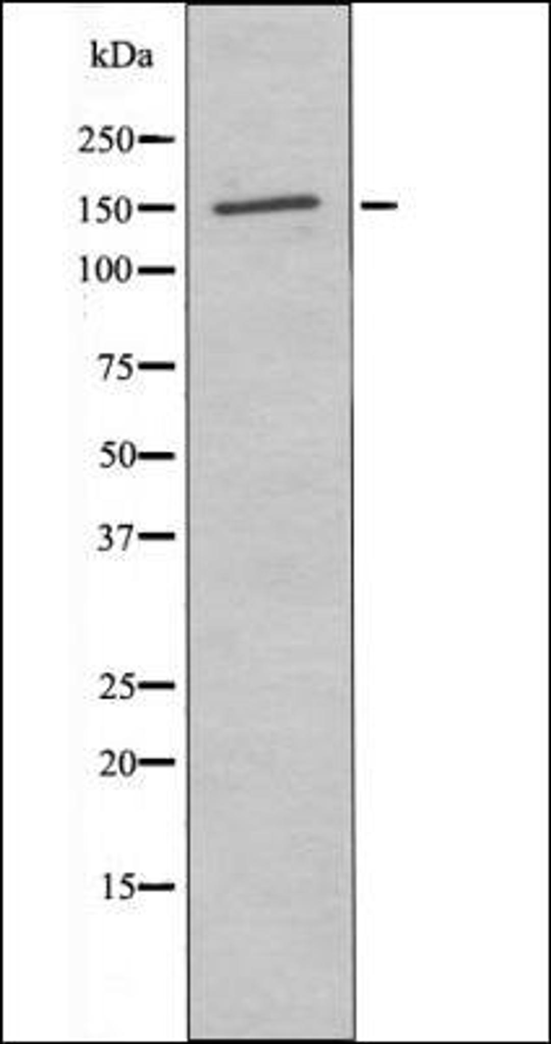 Western blot analysis of H2O2 treated 293 whole cell lysates using PLCG2 -Phospho-Tyr759- antibody