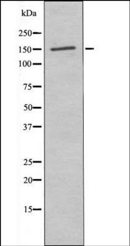 Western blot analysis of H2O2 treated 293 whole cell lysates using PLCG2 -Phospho-Tyr759- antibody