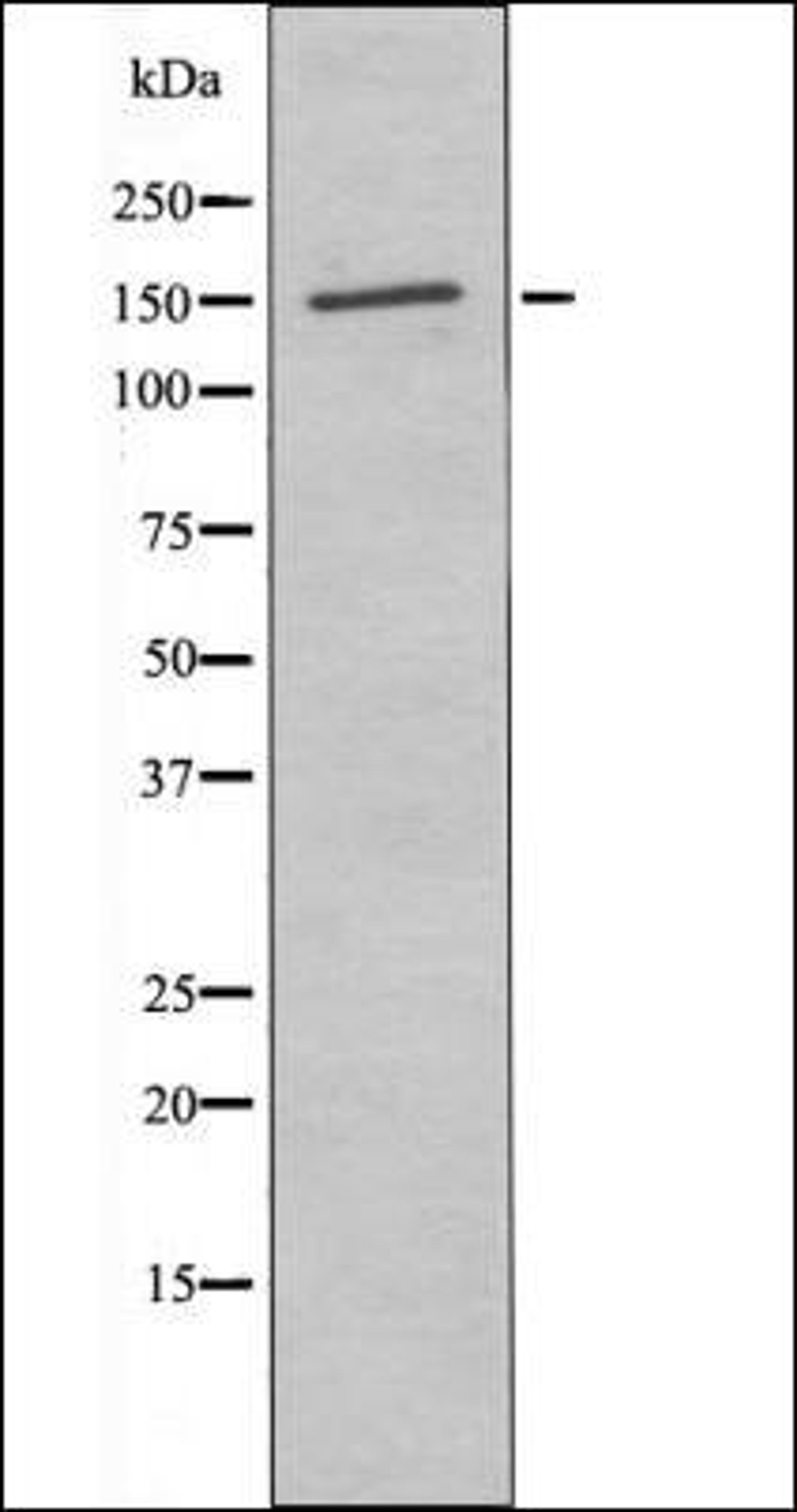 Western blot analysis of H2O2 treated 293 whole cell lysates using PLCG2 -Phospho-Tyr759- antibody