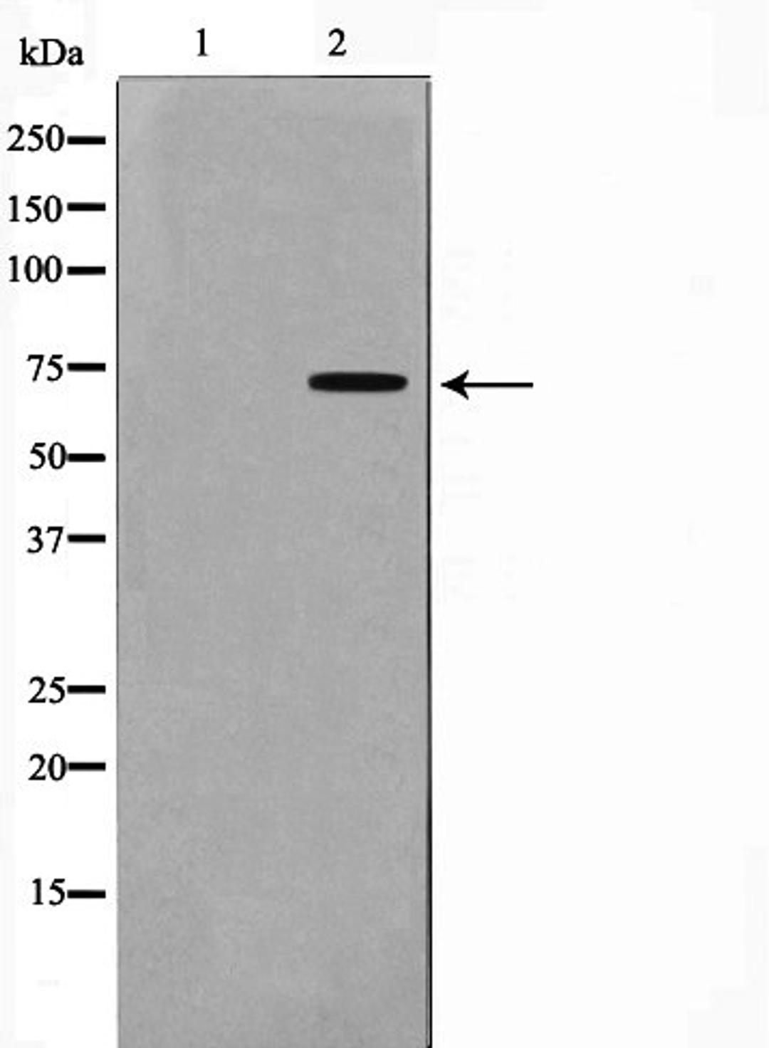 Western blot analysis of HuvEc cell lysate using GCYB1 antibody